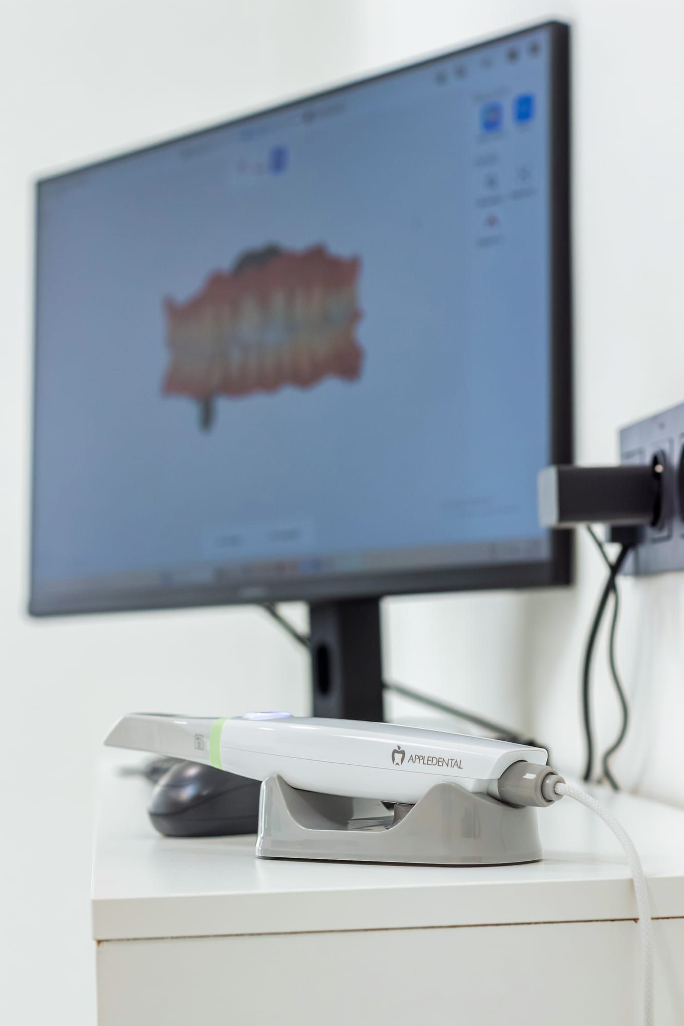 Scanner intra-oral posé sur son support, devant un écran affichant le modèle 3D d'une arcade dentaire
